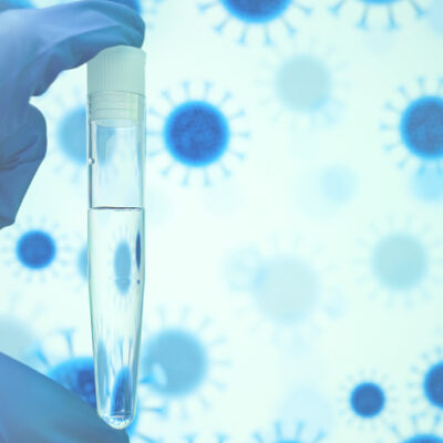 Gloved doctor's hand holds test tube with transparent liquid on background of bacteria illustration.